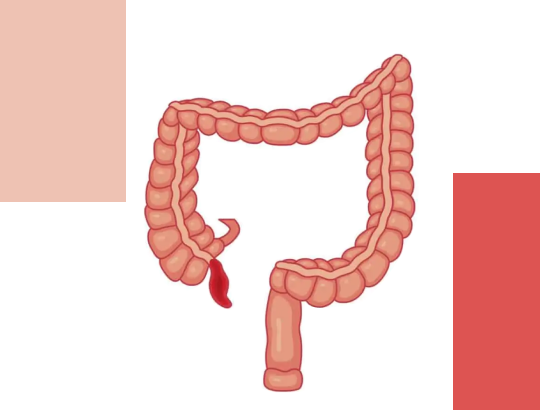 Шкала Альварадо